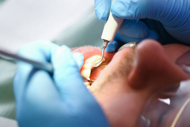 Best Emergency Care for Gum Disease in Port Lavaca, TX